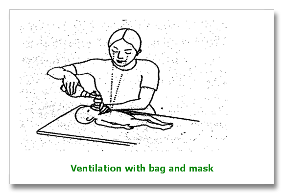 newborn resuscitation using ventilation with bag and mask