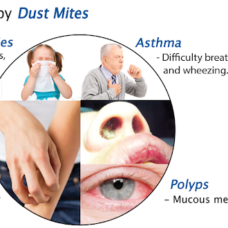 Can Indoor Air Purifiers remove Dust Mites? Yes very Efficiently.