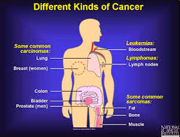 cancer types,causes and symptoms