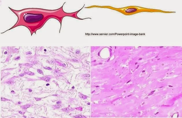 fibroblaste et fibrocyte