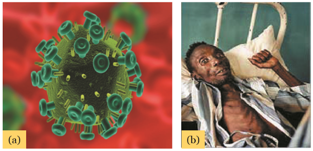 Gambar (a) Virus HIV, (b) Penderita HIV AIDS