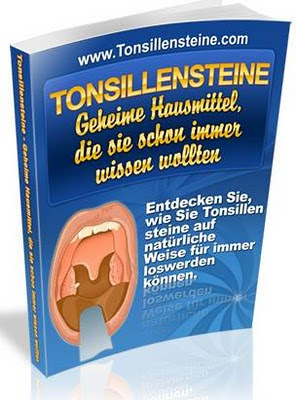 Mandelsteine, mandelsteine loswerden, tonsillensteine, mandeln, naturheilmittel, mundgeruch, mandelentzündung, tonsillen, mandel op, gegen mundgeruch