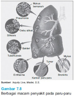 berbagai macam penyakit paru paru