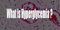 What is Hyperglycemia