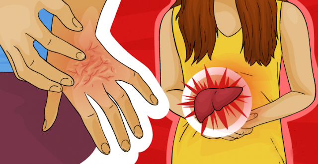 7 Reasons You Might Often Have Itching