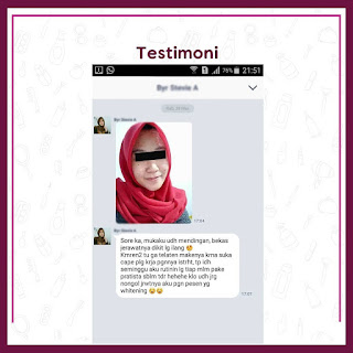 Testimoni Cara Paling Ampuh Menghilangkan Jerawat Pratista (84)