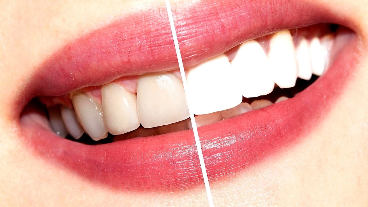 Clean White Teeth