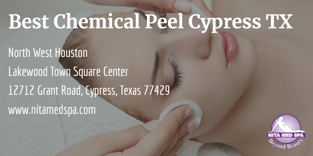 Best Chemical Peel Cypress TX