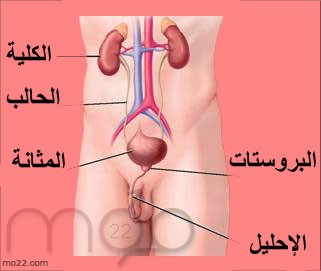 سرطان المثانة: الاسباب والاعراض و العلاج