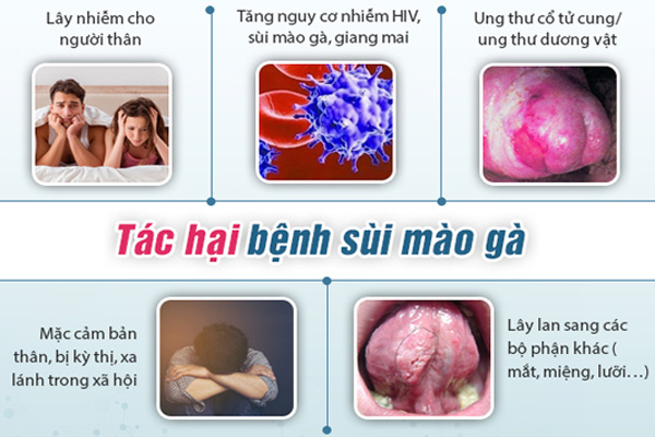 Biến chứng của sùi mào gà