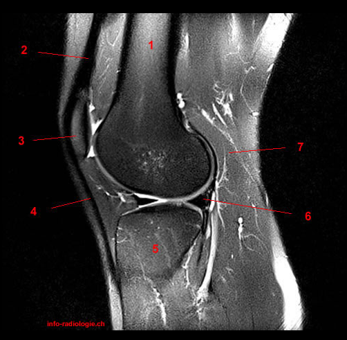 i love physical therapy: Atlas of knee MRI anatomy