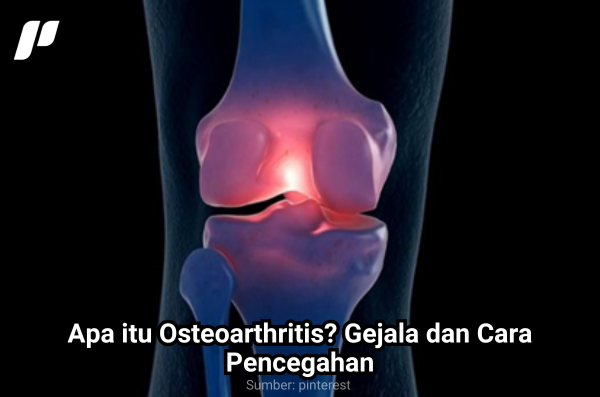 Osteoarthritis? Gejala dan Cara Pencegahan