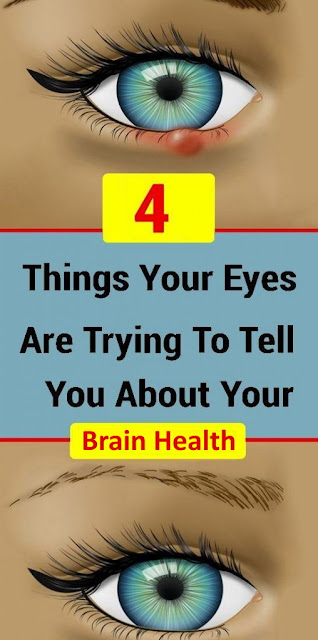 4 Things Your Eyes Reveal About Your Brain Health