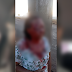 Idosa é brutalmente agredida em Sarandi, polícia suspeita que ela teria sido abusada sexualmente pelo criminoso 