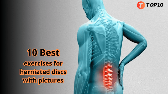 10 Best exercises for herniated discs with pictures