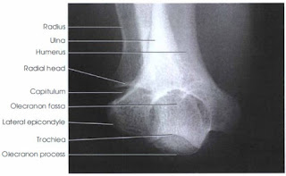 radiography