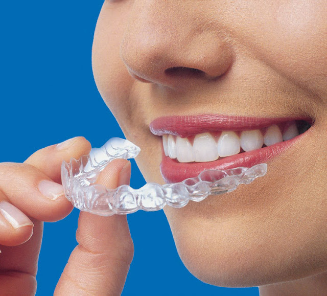 invisalign melbourne