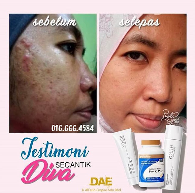 DAPATKAN KULIT CANTIK BEBAS CELA DENGAN SET SECANTIK DIVA