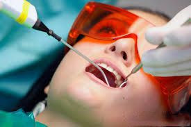 Răng sứ Zirconia duy trì bao lâu?