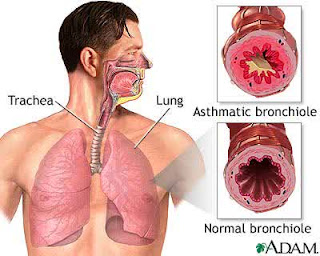 asthmatic bronchiole