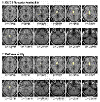 brain scans