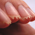 Finger Nail Design