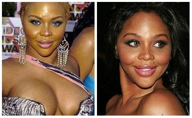 Lil Kim Bad Plastic Surgery