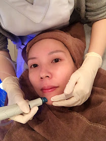 A-PLUS_Hydrafacial_05