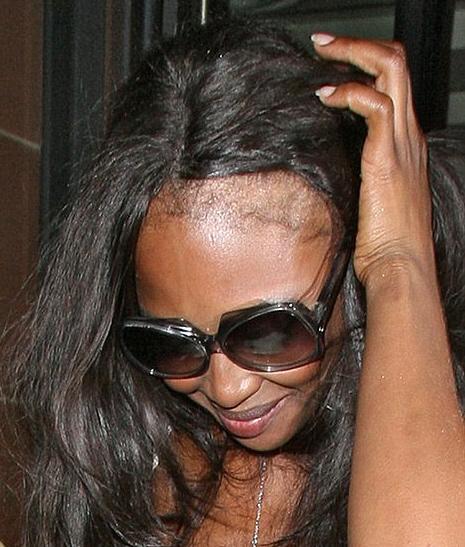 naomi campbell bald head. naomi campbell bald head.