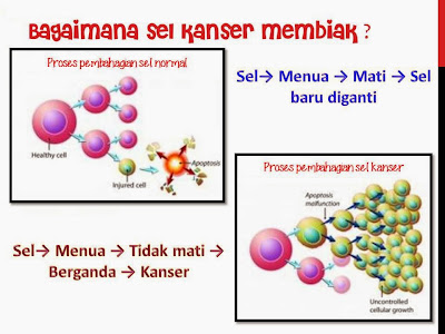 Image result for apa itu kanser