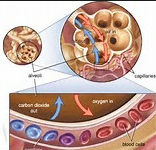 intervensi dan rasional gangguan pertukaran gas dan rasional NANDA NIC NOC terbaru, Diagnosa NANDA 2017, Diagnosa NANDA 2018, Diagnosa Nanda 2018-2020, Diagnosa NANDA 2015, diagnosa Nanda 2014, Diagnosa NANDA 2012, Diagnosa Doenges 