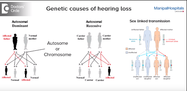 deafness-in-children