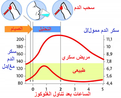 ما هو اختبار تحمل السكر الفموي OGTT