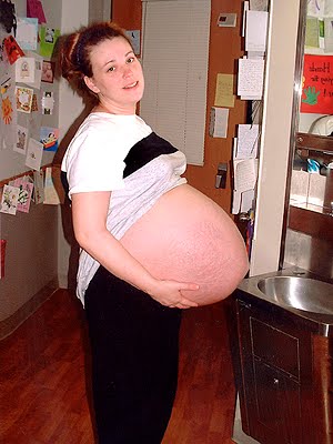  have horrifying images of Kate Gosselin's sextuplet pregnancy where her 