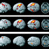 Técnicas de Neuromarketing (II): fMRI