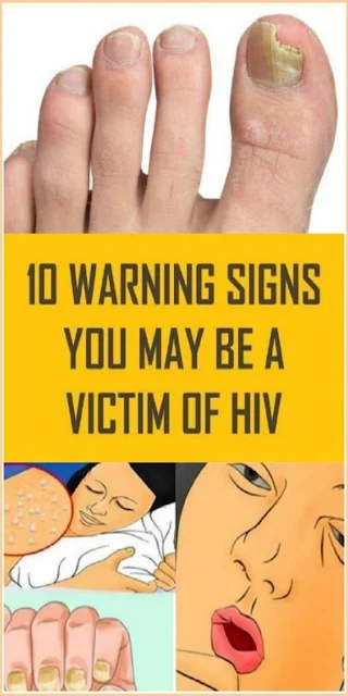 10 Warning Signs You May Be A Victim Of HIV