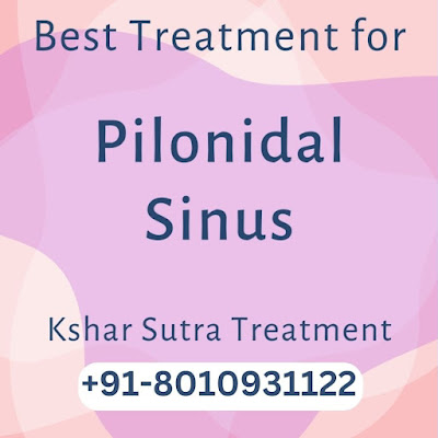 Effective Pilonidal Sinus Treatment in Gurugram: Find Relief Today!