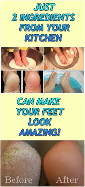 Just 2 Ingredients From Your Kitchen Can Make Your Feet Look Amazing!