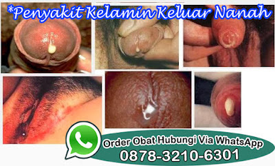 Obat Tradisional Penyembuh Kencing Sakit Keluar Nanah