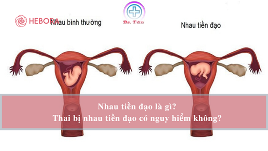 Hiểu Về Nhau Tiền Đạo Cho Chị Em