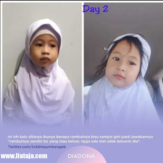 Gemes dan Imut Banget! Penampilan Siswa Perempuan Sebelum dan Sepulang Dari Sekolah - liataja.com