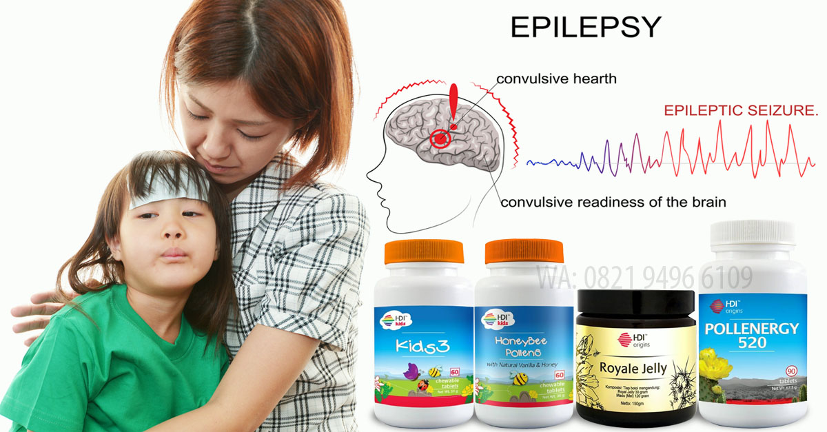 Epilepsi pada anak