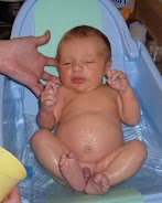 How Long After Circumcision Can Baby Have A Bath / How To Care For Your Baby S Penis Healthychildren Org - Your pediatrician will tell you how to massage the area to unclog the tear duct.