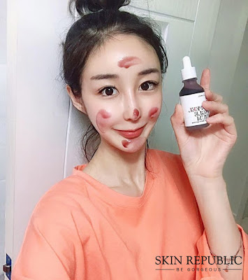 Đánh giá Red Peel Tingle Serum