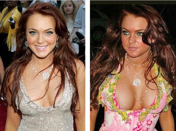 Top celebrities with breast implants Before After 