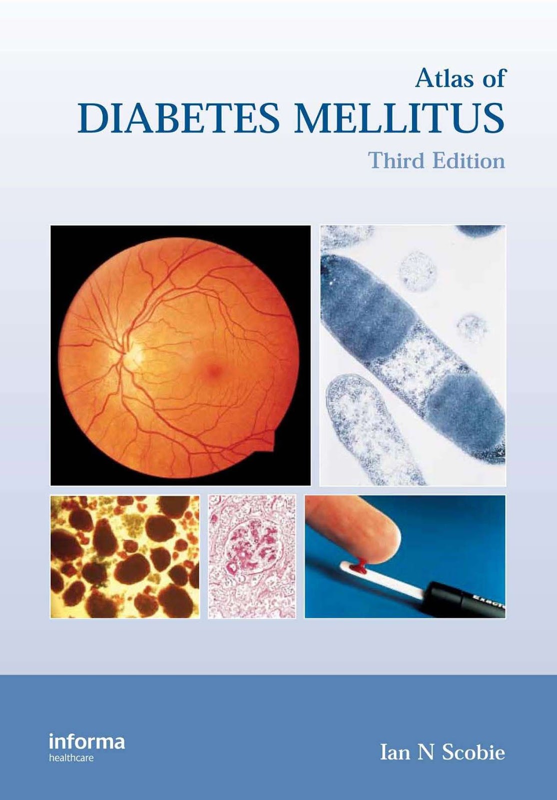 Atlas of Diabetes Mellitus, Third Edition - Free Ebook - 1001 Tutorial & Free Download