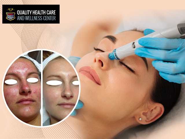 Hydrafacials New Jersey