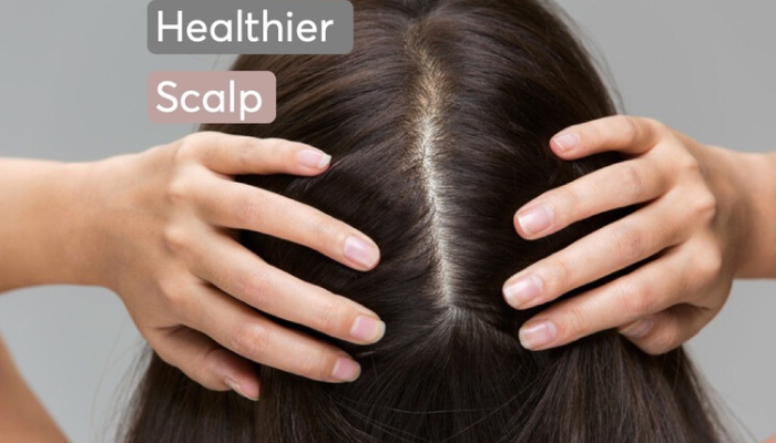 Top 10 Remedies to  prevent hair fall in rainy season