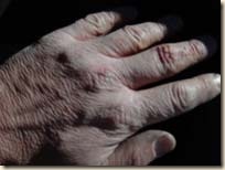 hands1