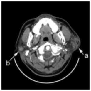 What Is Computerized tomography